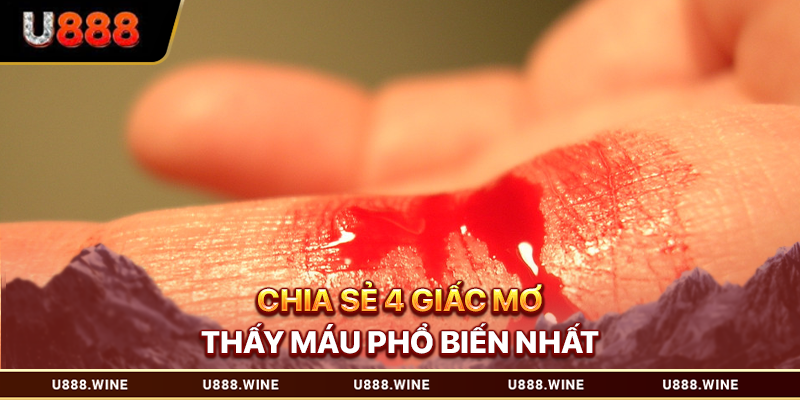 Chia sẻ 4 giấc mơ thấy máu phổ biến nhất